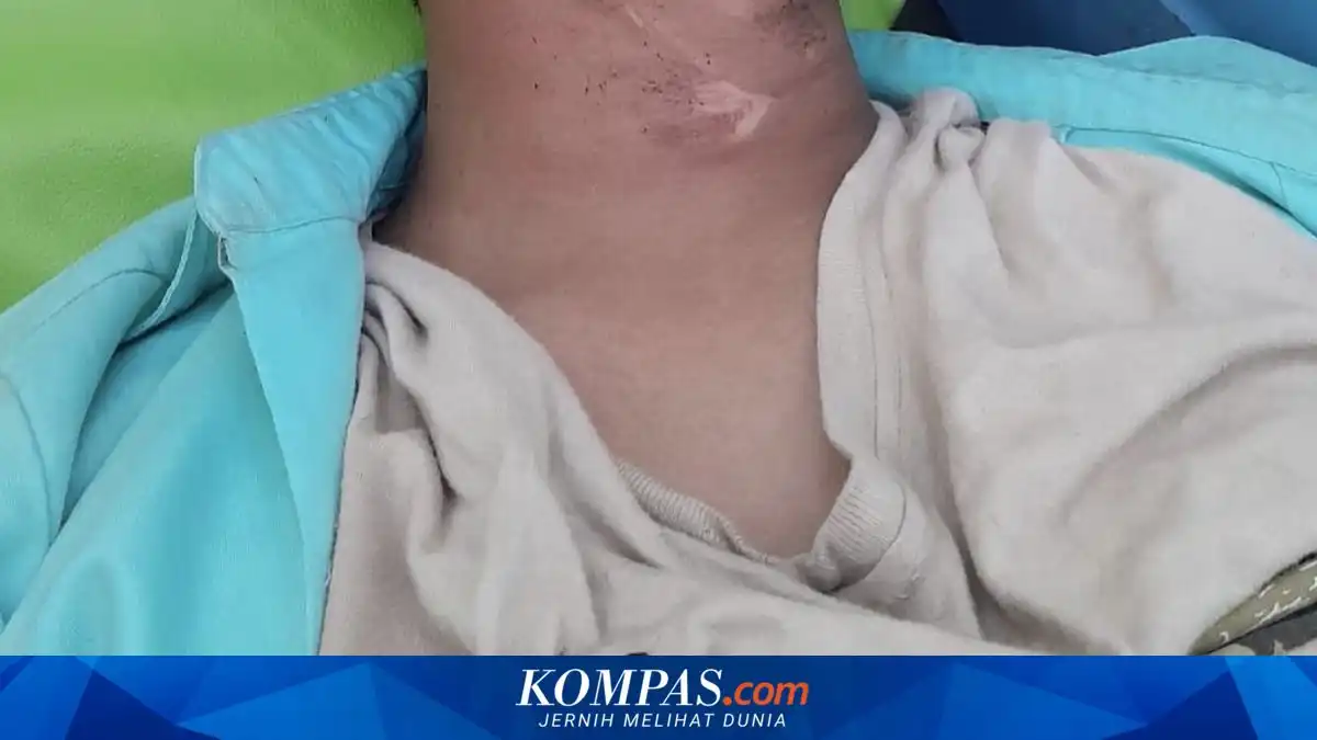 Siswa SMAN 2 Bangkalan Terluka Setelah Terjerat Kabel di Dekat Proyek Gorong-gorong