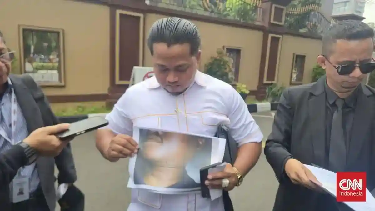 Keluarga Anto Adukan Dugaan Penganiayaan di Polsek Kajang ke Propam